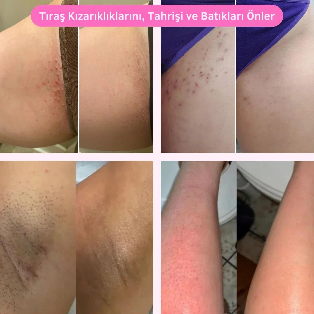 Velisia™ – Acısız & İz Bırakmayan Tüy Alma Cihazı